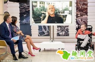 人类换头术能否成功？这