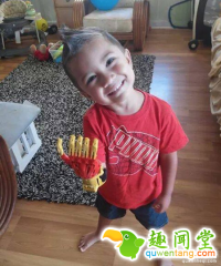 3岁男孩天生无手指，3D打印让他变身钢铁侠