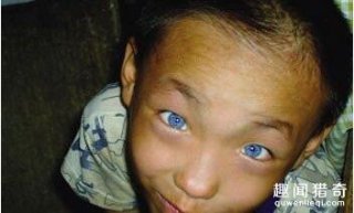 天生一双神奇“猫眼”  男孩竟能夜视