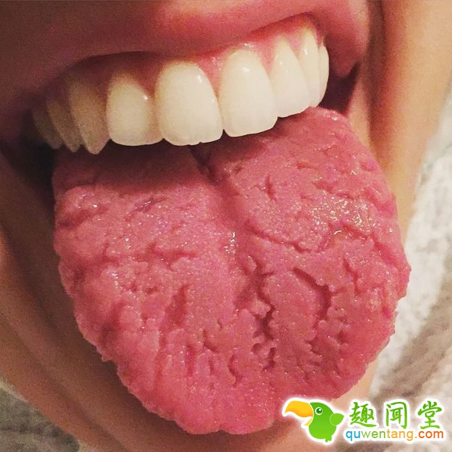 如果你有这9种「你以为不重要的恼人小毛病」，代表你的身体正因为缺乏某种营养即将崩溃！