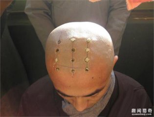 和尚头上为什么有点？一般都是几个？