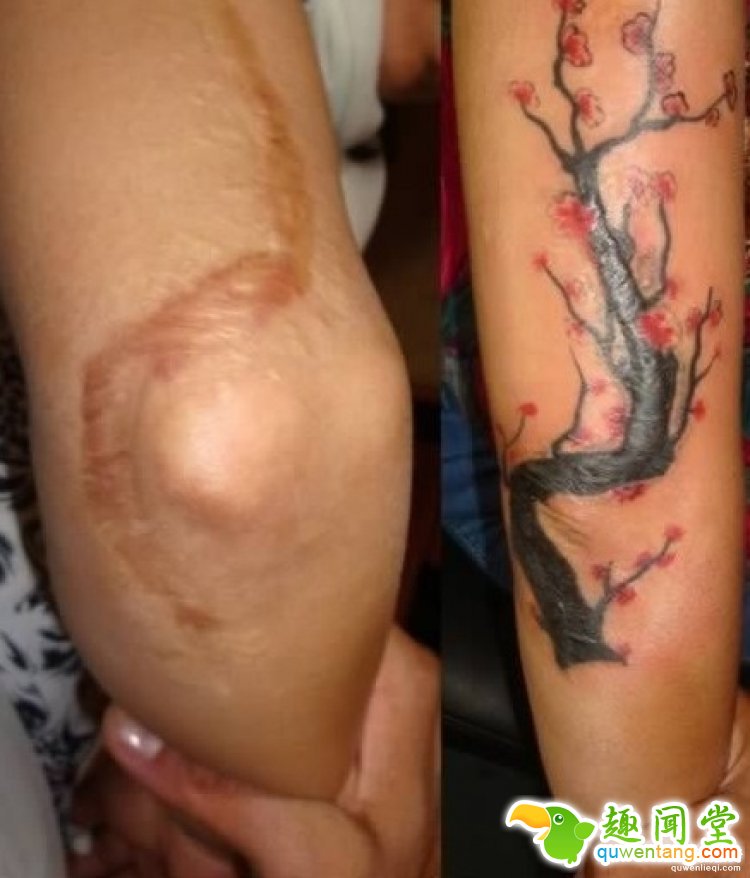 纹身拯救伤疤，甚至还能还你一只“眼睛”！