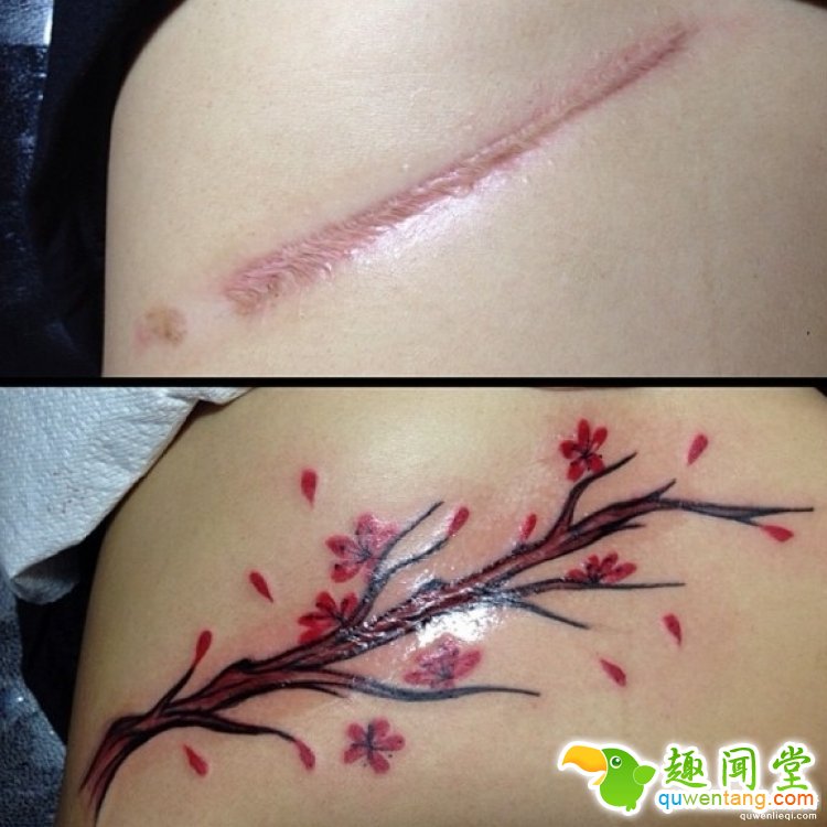 纹身拯救伤疤，甚至还能还你一只“眼睛”！