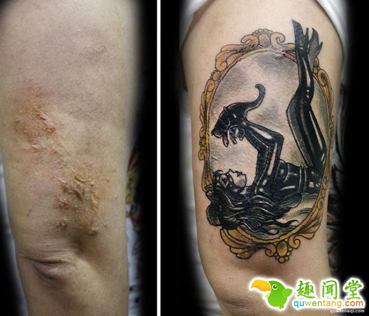 纹身拯救伤疤，甚至还能还你一只“眼睛”！