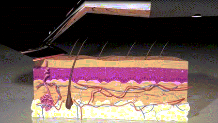 美研制新型激光剃须刀：瞬间熔化毛发不伤皮肤