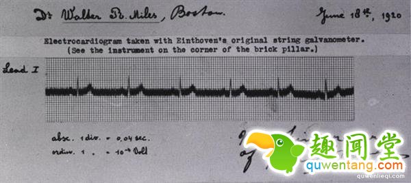 信不信由你 有人靠这发明拿了诺贝尔奖！