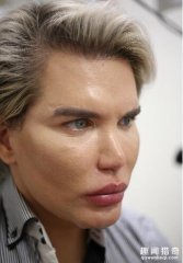 英国男子整容上瘾全身动100多处  又打算改