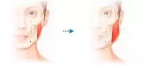 女人越长越丑，全是因为这20个坏习惯！