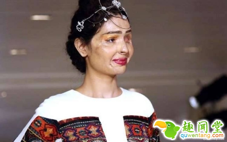 “我很勇敢”——印度被硫酸毁容女孩走上纽约时装周T台