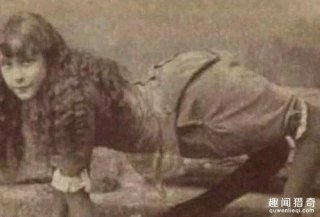 惊！她貌美女花却先天膝盖畸形，只能四肢