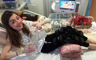 谨慎运动！运动过后她突然患怪病，一兴奋